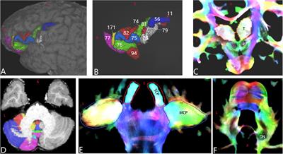 Evidence for Reciprocal Structural Network Interactions Between Bilateral Crus Lobes and Broca’s Complex